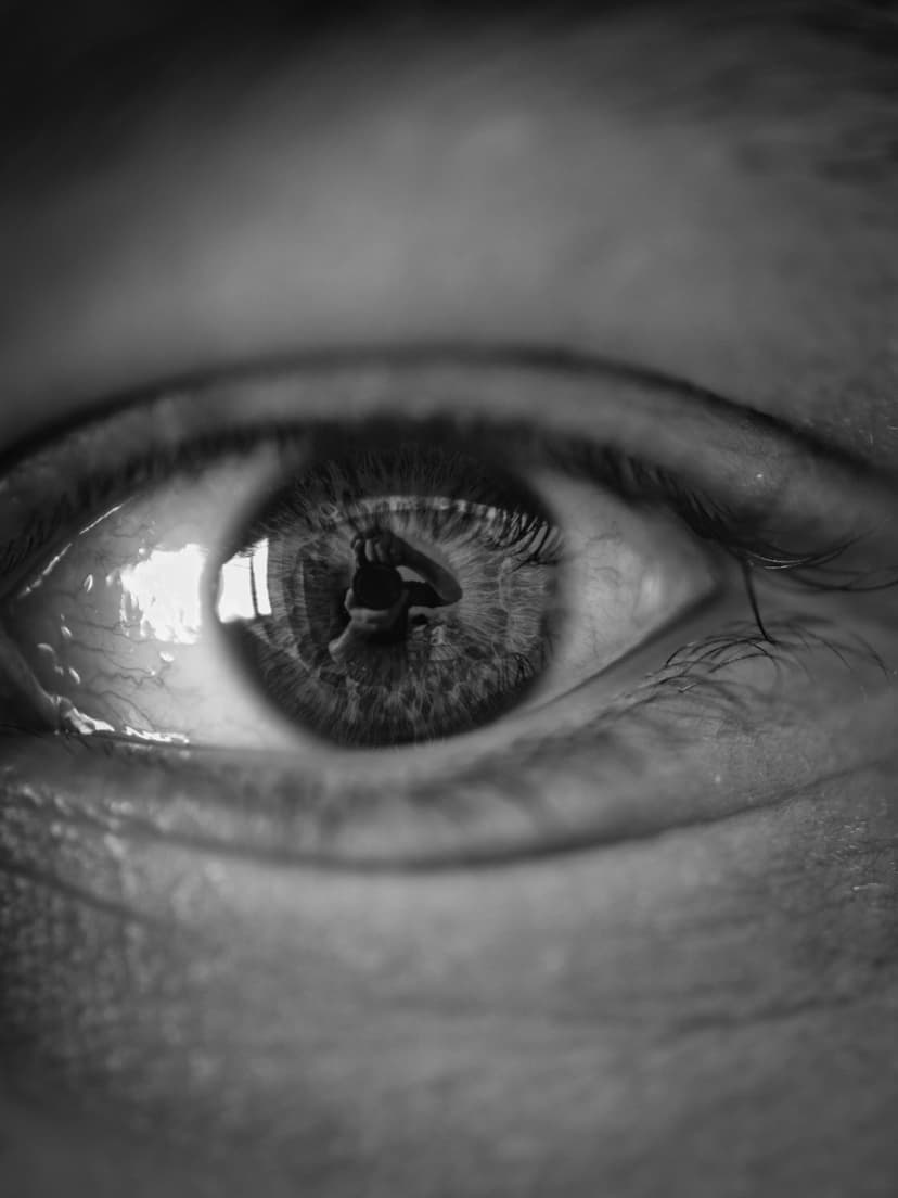 Contact Lenses